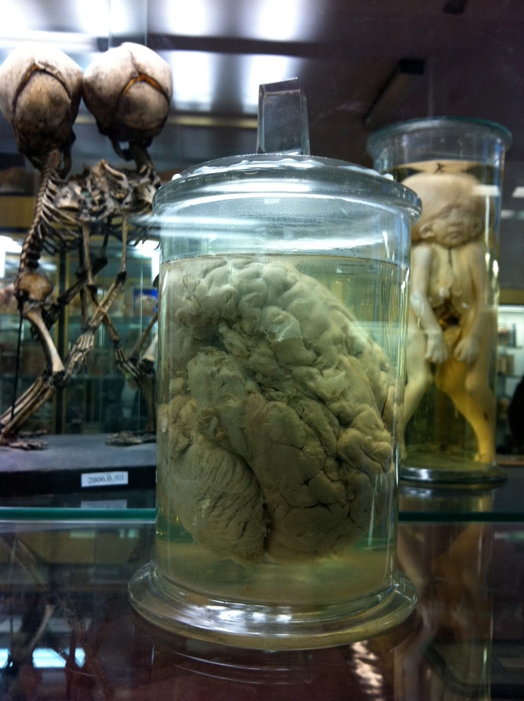 Monsieur Tan's brain, Musee Dupuytren, Paris by Rosa Longo (3).jpg